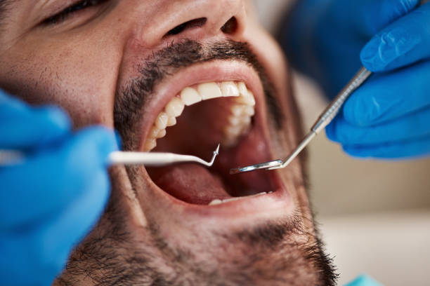 Best Dentist for Tooth Abscess  in Millersburg, PA